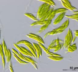 Ankistrodesmus densus Ankistrodesmus densus