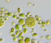 Pseudochlorella pringsheimii