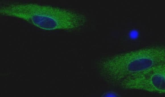 Humane metastasierende Melanomzellen wurden mit 3 μM Simvastatin für 48 Stunden behandelt.
