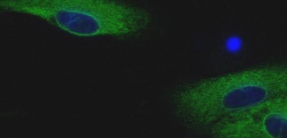 Humane metastasierende Melanomzellen Humane metastasierende Melanomzellen wurden mit 3 μM Simvastatin für 48 Stunden behandelt.