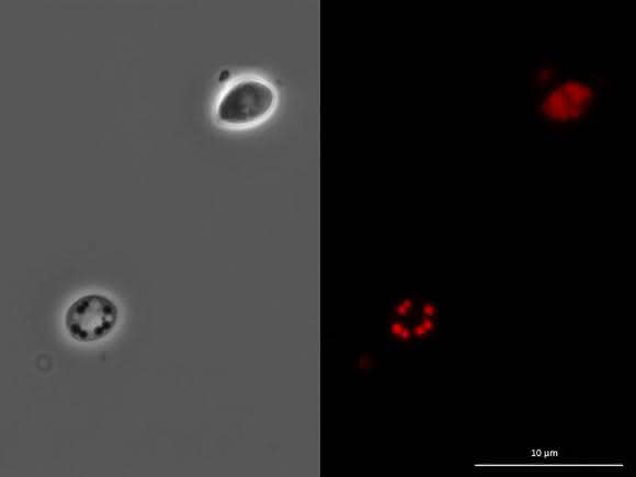 Zellen der Hefe Trichosporon oleaginosus. Anfärbung mit Nilrot macht den Ölgehalt der Zellen sichtbar. (Bild: Veronika Redai / TUM)