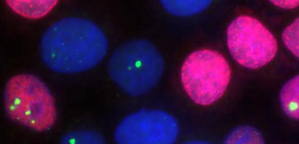 Das Forscherteam benutzte für seine Studie einen zellulären Ansatz, in welchem die Zellkerne (blau) von Tumorzellen mittels Immunofluoreszenz-Mikroskopie in ihren jeweiligen Zellzyklusphasen erkennbar sind. Replikative Zellen (rot) lassen sich hier von post-replikativen Zellen unterscheiden. In den Zellkernen wurde zusätzlich ein Protein (grün) angefärbt, das unreparierte DNA-Doppelstrangbrüche markiert. (Bild: Julian Spies / TU Darmstadt)