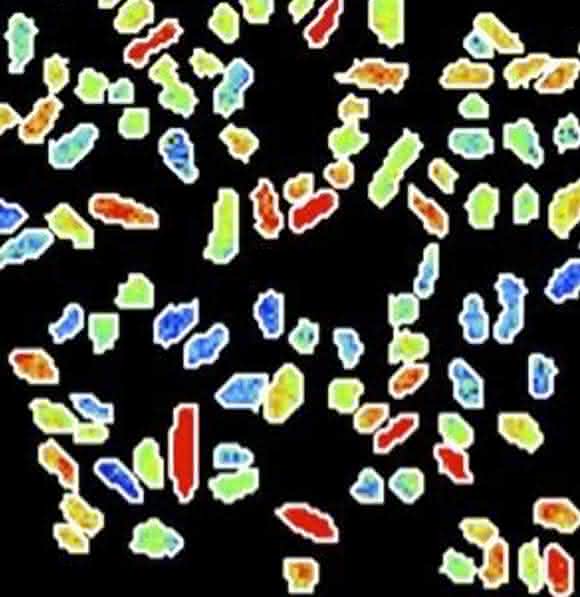 Bakterium Klebsiella oxytoca