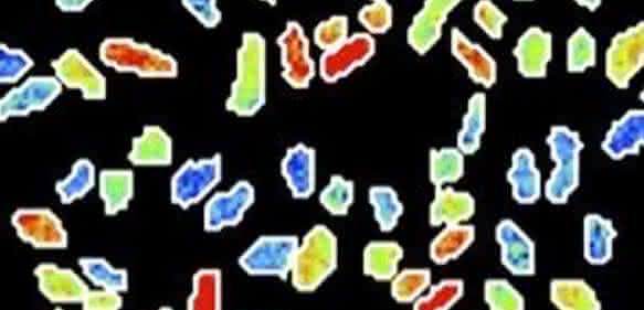 Bakterium Klebsiella oxytoca