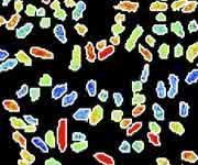 Bakterium Klebsiella oxytoca