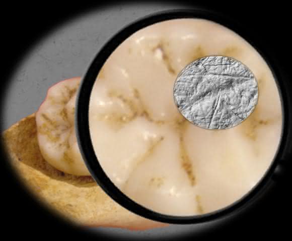 Die Dental Microwear Texture Analysis – die Zahnabnutzungsanalyse, die in der Studie verwendet wurde –, umfasst die Untersuchung und Analyse von winzigen Abnutzungsspuren auf der Zahnoberfläche im Größenbereich unter einem Mikrometer. (Abbildung: Sireen El Zaatari)