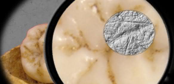 Die Dental Microwear Texture Analysis – die Zahnabnutzungsanalyse, die in der Studie verwendet wurde –, umfasst die Untersuchung und Analyse von winzigen Abnutzungsspuren auf der Zahnoberfläche im Größenbereich unter einem Mikrometer. (Abbildung: Sireen El Zaatari)