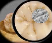 Die Dental Microwear Texture Analysis – die Zahnabnutzungsanalyse, die in der Studie verwendet wurde –, umfasst die Untersuchung und Analyse von winzigen Abnutzungsspuren auf der Zahnoberfläche im Größenbereich unter einem Mikrometer. (Abbildung: Sireen El Zaatari)
