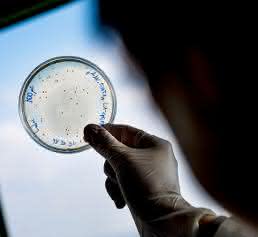 Bakterium E. Coli