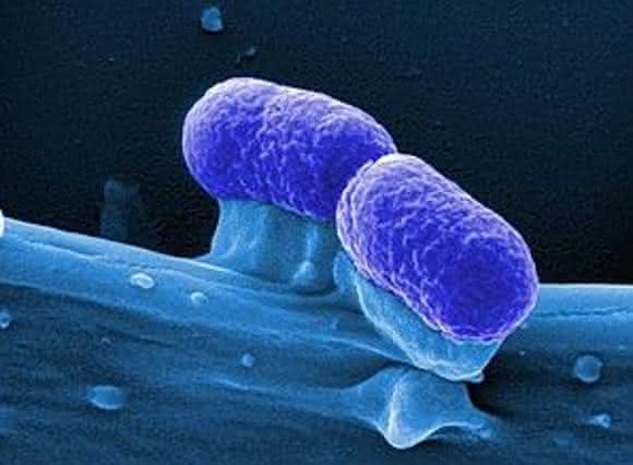 E. coli-Bakterien