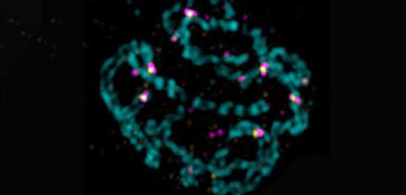 Elternchromosomen Elternchromosomen