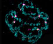 Elternchromosomen