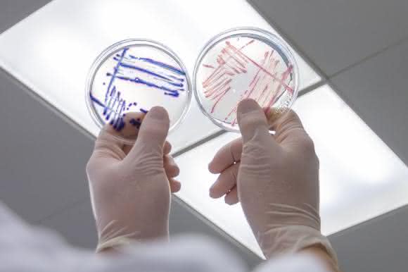 Nachweis von Escherichia coli und coliformen Bakterien