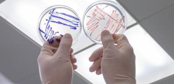 Nachweis von Escherichia coli und coliformen Bakterien Nachweis von Escherichia coli und coliformen Bakterien