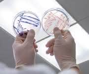 Nachweis von Escherichia coli und coliformen Bakterien