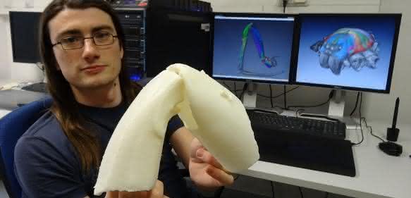 3D-gedrucktes Spinnenknie