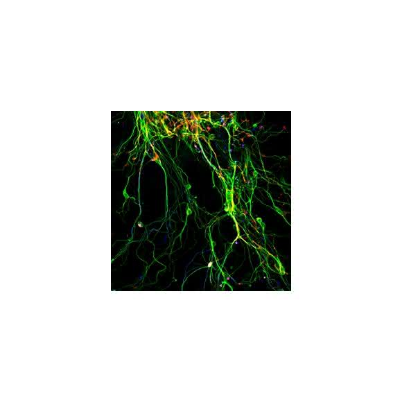 Neuronen aus direkter Reprogrammierung. (Aufnahme: Lehrstuhl Götz)