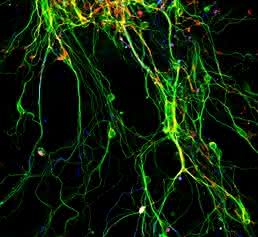 Neuronen aus direkter Reprogrammierung. (Aufnahme: Lehrstuhl Götz)