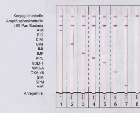 Neuer Line-Probe-Assay: Schneller und gezielter Nachweis von 13 Carbapenemasen