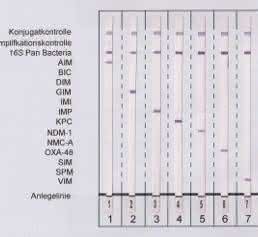 Neuer Line-Probe-Assay: Schneller und gezielter Nachweis von 13 Carbapenemasen