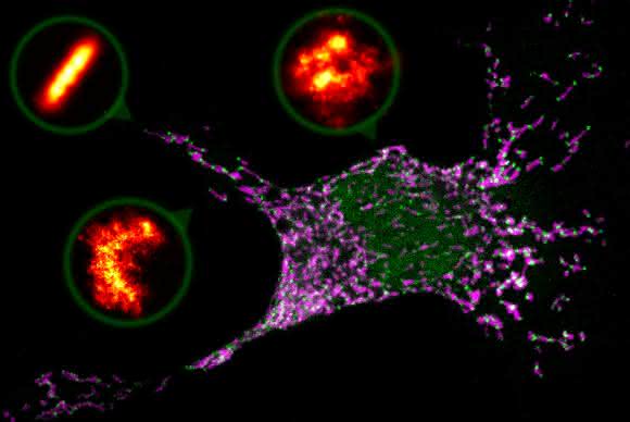 Programmierter Zelltod: Poren in Form von Ringen und Halbmonden treiben gestresste Zelle in die Apoptose Programmierter Zelltod: Poren in Form von Ringen und Halbmonden treiben gestresste Zelle in die Apoptose