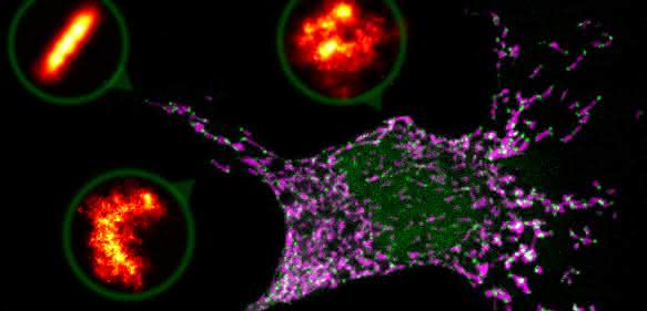 Programmierter Zelltod: Poren in Form von Ringen und Halbmonden treiben gestresste Zelle in die Apoptose Programmierter Zelltod: Poren in Form von Ringen und Halbmonden treiben gestresste Zelle in die Apoptose