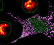 Programmierter Zelltod: Poren in Form von Ringen und Halbmonden treiben gestresste Zelle in die Apoptose Programmierter Zelltod: Poren in Form von Ringen und Halbmonden treiben gestresste Zelle in die Apoptose