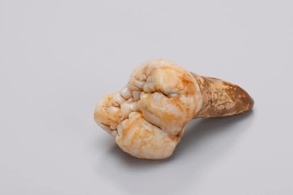 Großer Backenzahn von Gigantopithecus aus der Gustav Heinrich Ralph von Koenigswald-Sammlung im Senckenberg Forschungsinstitut. (© Wolfgang Fuhrmannek)
