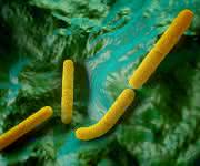 Molekularbiologischer Nachweis: Clostridium botulinum in Nahrungsmitteln