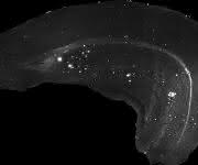 Amyloid-Beta-Proteins im Gehirn