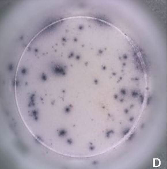 Sensitive und spezifische Diagnose im Frühstadium: Lyme Borreliose