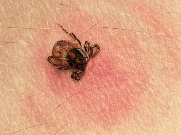 Sensitive und spezifische Diagnose im Frühstadium: Lyme Borreliose