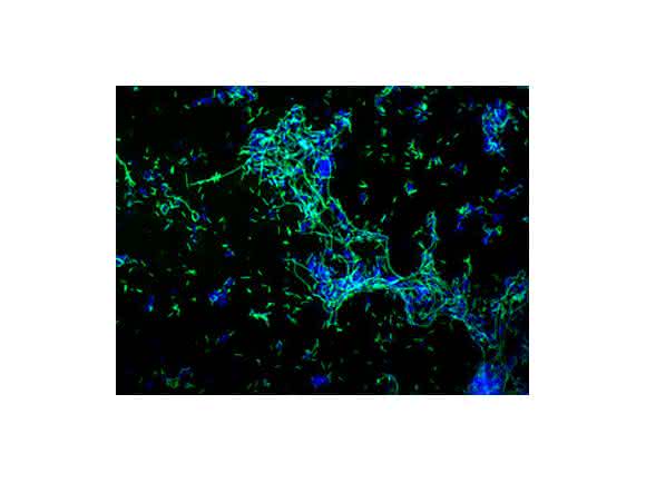 Epifluoreszenzmikroskopische Aufnahme von einem Biofilm von Legionella pneumophila (grün, Immunfluoreszenzfärbung) mit anderen Wasserbakterien (blau). (Bild: HZI / AG Höfle / Elisa Andreozzi)