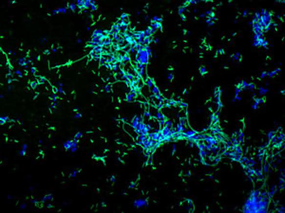 Epifluoreszenzmikroskopische Aufnahme von einem Biofilm von Legionella pneumophila (grün, Immunfluoreszenzfärbung) mit anderen Wasserbakterien (blau). (Bild: HZI / AG Höfle / Elisa Andreozzi)