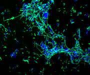Epifluoreszenzmikroskopische Aufnahme von einem Biofilm von Legionella pneumophila (grün, Immunfluoreszenzfärbung) mit anderen Wasserbakterien (blau). (Bild: HZI / AG Höfle / Elisa Andreozzi)