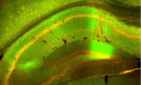 Produktion von APPsα im Gehirn: Die von viralen Genfähren getroffenen Nervenzellen produzieren das therapeutische APPsα Protein (orange) und gleichzeitig ein grünes Fluoreszenzprotein. Gehirnregion: Hippocampus, eine wichtige Region für Lernen und Gedächtnis. (Quelle: S. Weyer, IPMB)