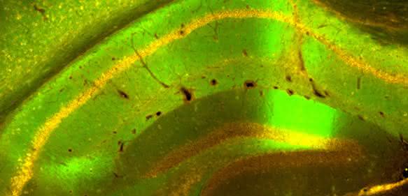 Produktion von APPsα im Gehirn: Die von viralen Genfähren getroffenen Nervenzellen produzieren das therapeutische APPsα Protein (orange) und gleichzeitig ein grünes Fluoreszenzprotein. Gehirnregion: Hippocampus, eine wichtige Region für Lernen und Gedächtnis. (Quelle: S. Weyer, IPMB)