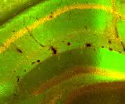Produktion von APPsα im Gehirn: Die von viralen Genfähren getroffenen Nervenzellen produzieren das therapeutische APPsα Protein (orange) und gleichzeitig ein grünes Fluoreszenzprotein. Gehirnregion: Hippocampus, eine wichtige Region für Lernen und Gedächtnis. (Quelle: S. Weyer, IPMB)
