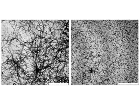 beta-Amyloid