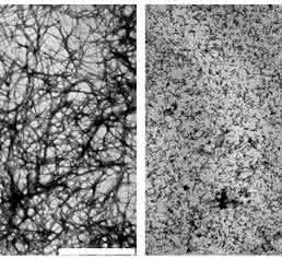 beta-Amyloid beta-Amyloid