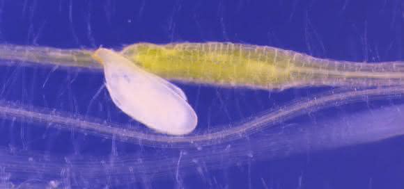 Rübenzystennematode