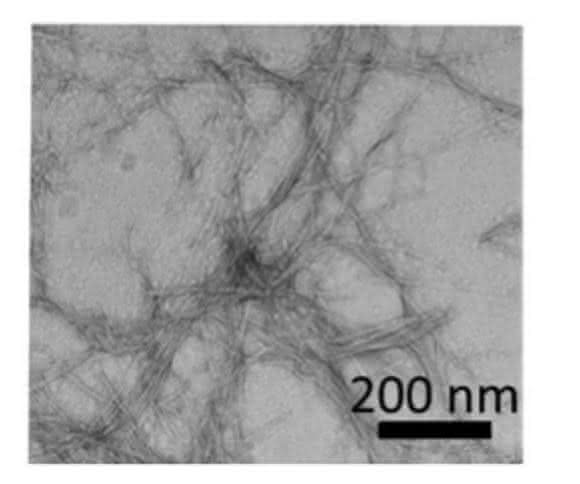 Amyloidplaques bei Alzheimer und Diabetes: Neue Leitstrukturen für Therapeutika