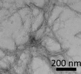 Amyloidplaques bei Alzheimer und Diabetes: Neue Leitstrukturen für Therapeutika