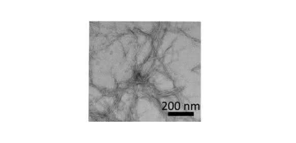 Amyloidplaques bei Alzheimer und Diabetes: Neue Leitstrukturen für Therapeutika