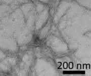 Amyloidplaques bei Alzheimer und Diabetes: Neue Leitstrukturen für Therapeutika
