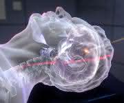 Protonentherapie Protonentherapie