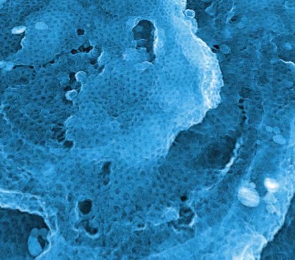 Regelmäßiges Clathrin-Gitter auf einer Aluminium-Oberfläche (Aufnahme mit dem Elektronenmikroskop, ca. 1,5 x 1,5 µm). Regelmäßiges Clathrin-Gitter auf einer Aluminium-Oberfläche (Aufnahme mit dem Elektronenmikroskop, ca. 1,5 x 1,5 µm).