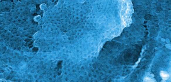 Regelmäßiges Clathrin-Gitter auf einer Aluminium-Oberfläche (Aufnahme mit dem Elektronenmikroskop, ca. 1,5 x 1,5 µm).