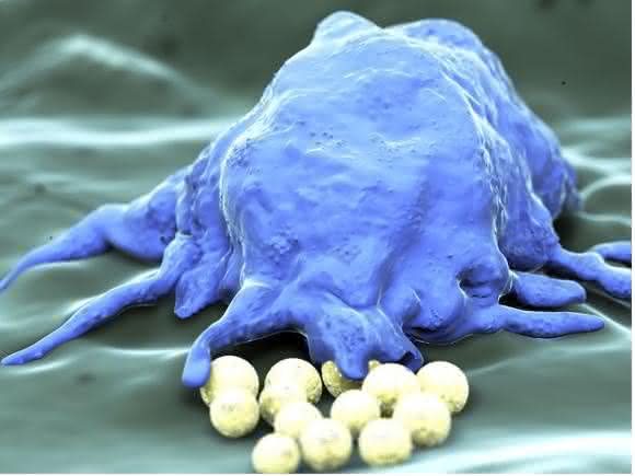 Macrophage Polarization-Introduction