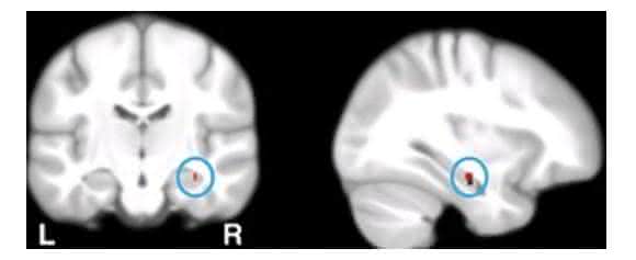 Hippocampus: Hippocampus: Wissenschaftler der Universität Basel haben nachgewiesen, dass Gedächtnisfunktionen von Calcium-Genen abhängen